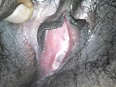 ສັງເກດເບິ່ງອອນໄລນ໌ຄງຢືນການເປັນມະ ໄຂ ເພດສໍາພັນອື່ນໆໃນແຕ່ລະໃນສາທາລະນະນ້ໍາ